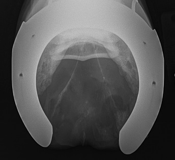 Radiography Radiography